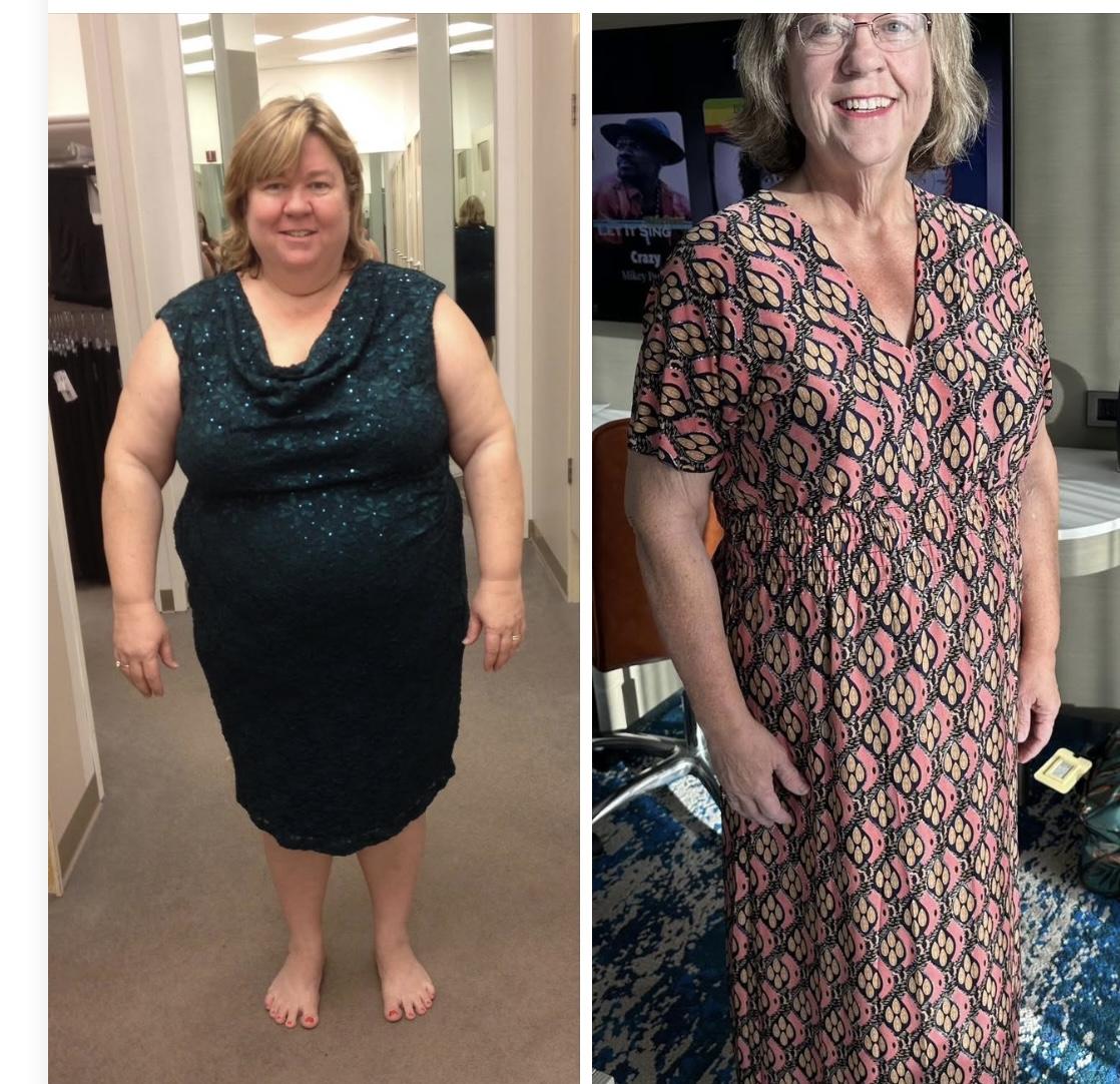 Dresses Before and After 5-Bite